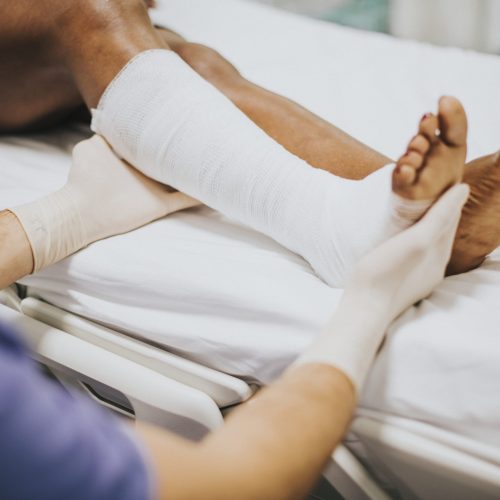 doctor-helping-patient-with-fractured-leg